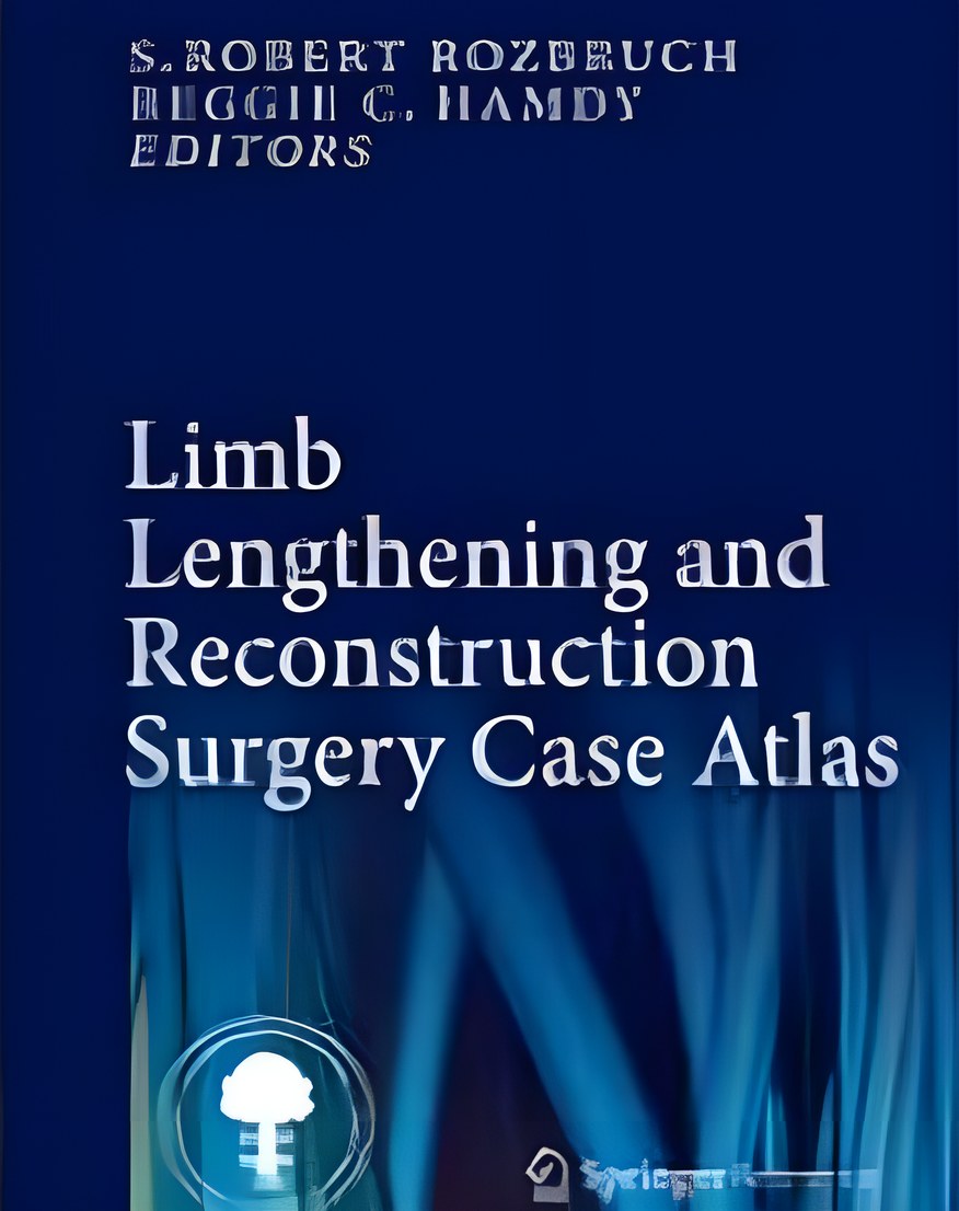 Limb Lengthening and Reconstruction Surgery Case Atlas